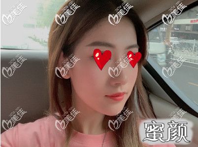 https://img.yiyiaimei.com/mnt/timg/200530/142U14a5-2.jpg