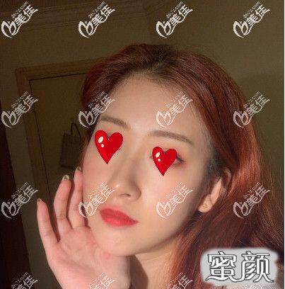 https://img.yiyiaimei.com/mnt/timg/200530/142U430B-3.jpg