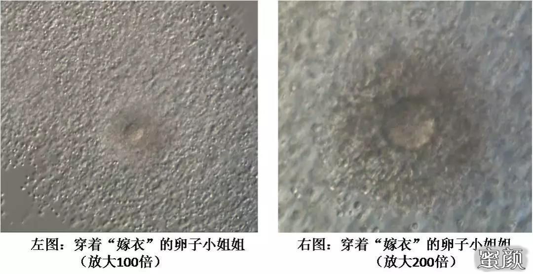 https://img.yiyiaimei.com/mnt/timg/200530/162245F33-3.jpg
