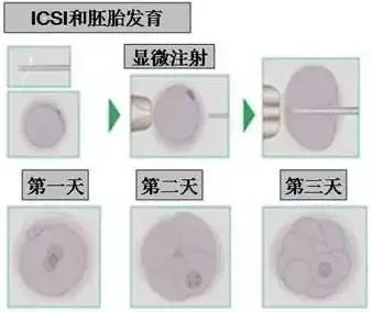 https://img.yiyiaimei.com/mnt/timg/200530/16262W1b-8.jpg