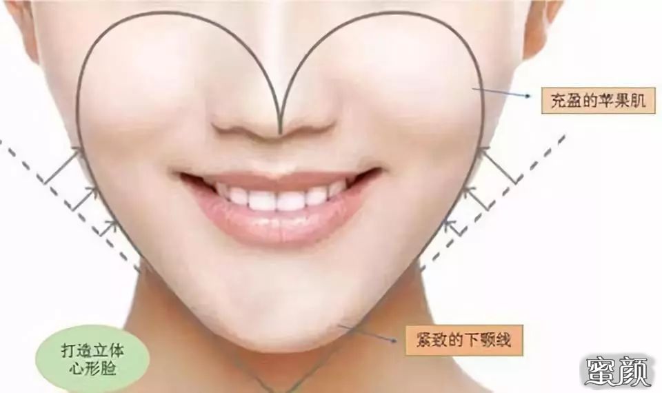 https://img.yiyiaimei.com/mnt/timg/200531/10440H948-3.jpg 案例图片