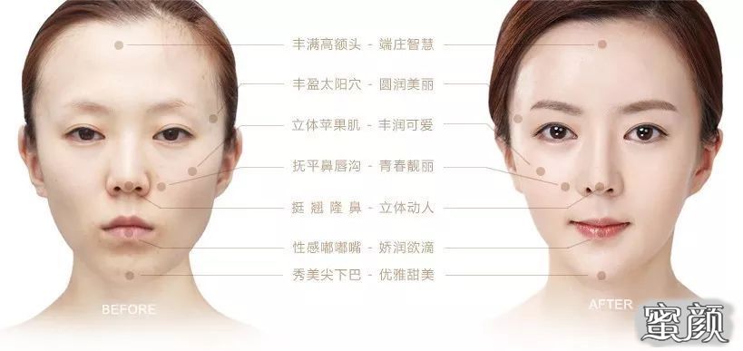 https://img.yiyiaimei.com/mnt/timg/200531/10440LS9-2.jpg 案例图片
