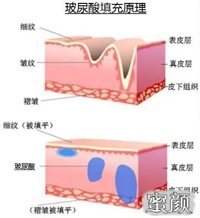 案例图片