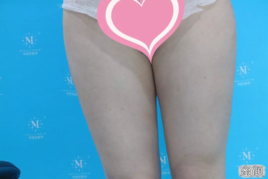 案例图片