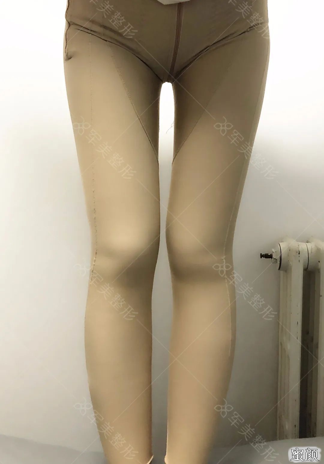 案例图片
