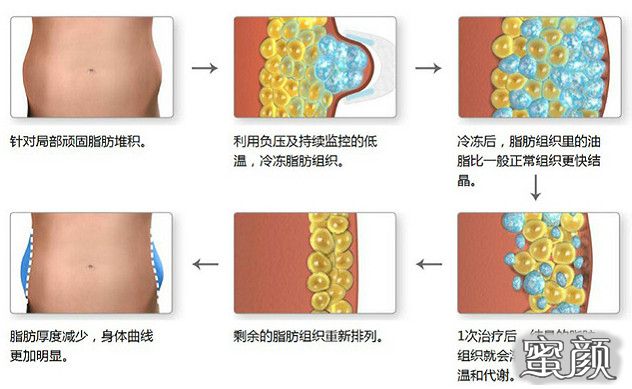 案例图片