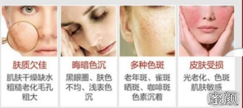 https://img.yiyiaimei.com/mnt/timg/200604/1621443944-3.jpg 案例图片