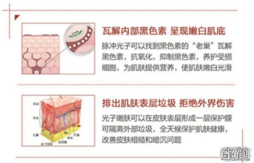 https://img.yiyiaimei.com/mnt/timg/200604/162144M27-2.jpg 案例图片
