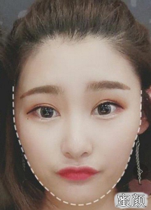 案例图片