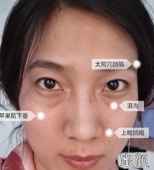 案例图片