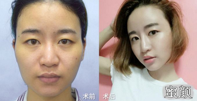 案例图片
