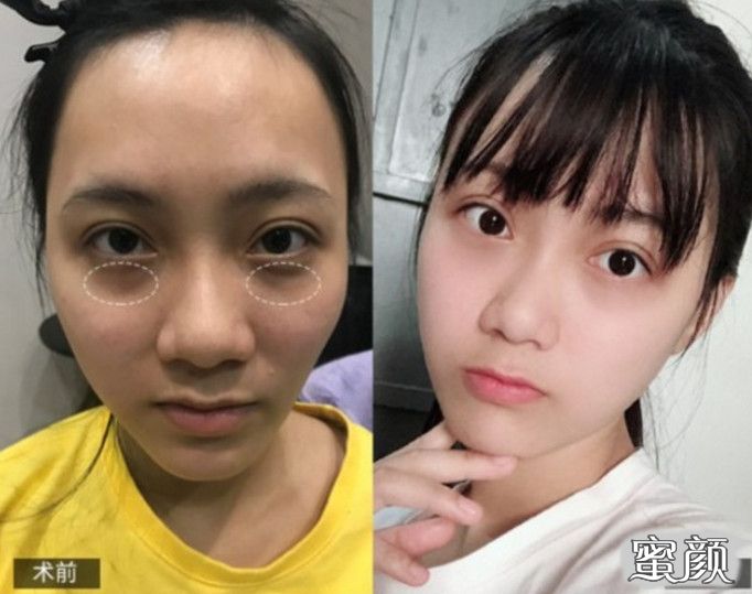 案例图片
