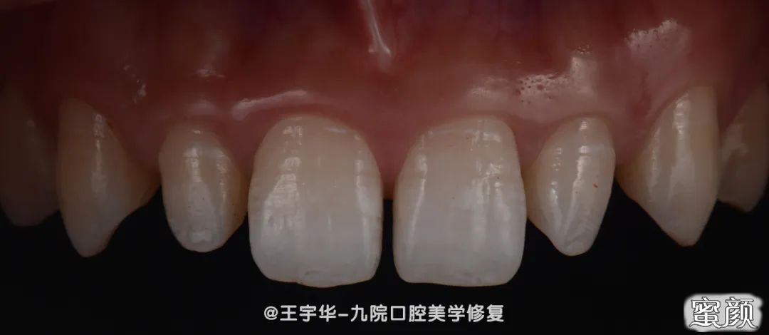 案例图片