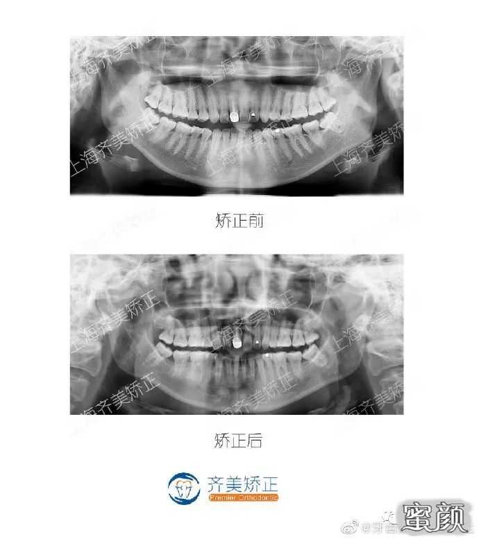 案例图片