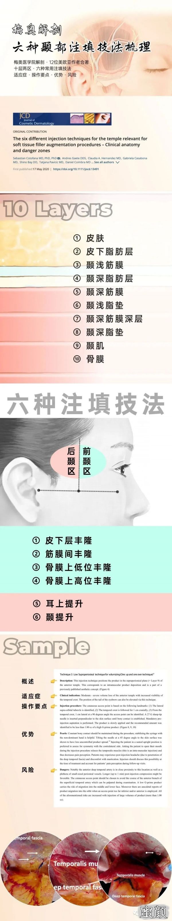 案例图片