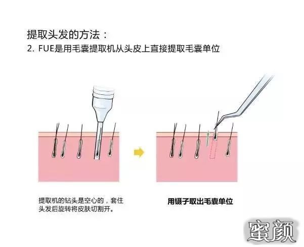 案例图片