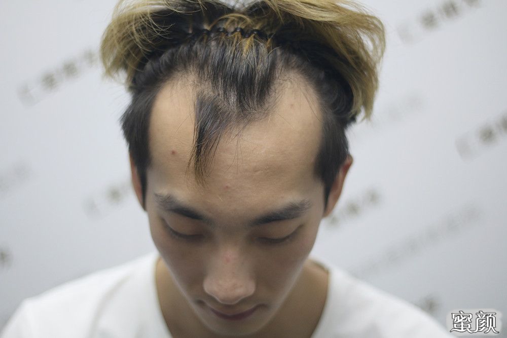 https://img.yiyiaimei.com/mnt/timg/200605/11562C161-0.jpg
