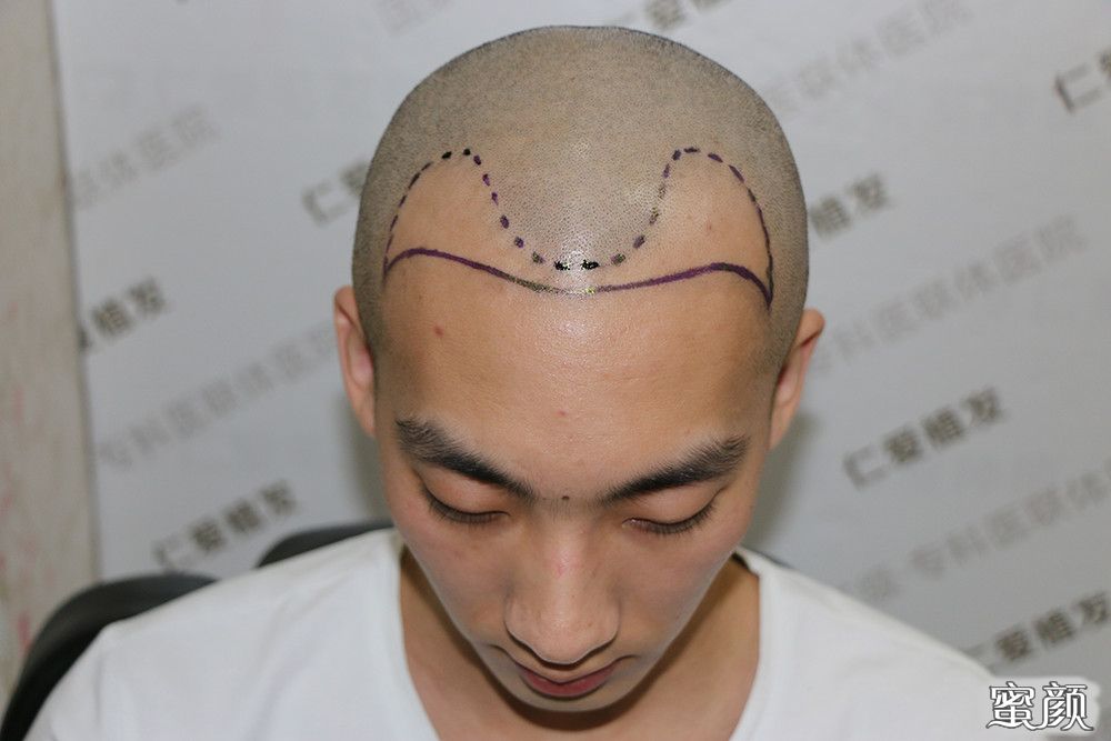 https://img.yiyiaimei.com/mnt/timg/200605/1156344264-1.jpg