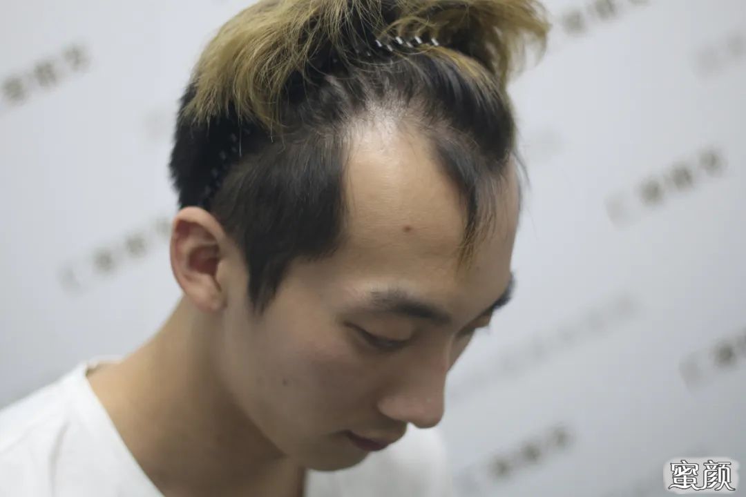 https://img.yiyiaimei.com/mnt/timg/200605/1156354310-4.jpg