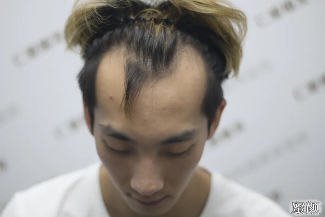 https://img.yiyiaimei.com/mnt/timg/200605/115635H42-2.jpg