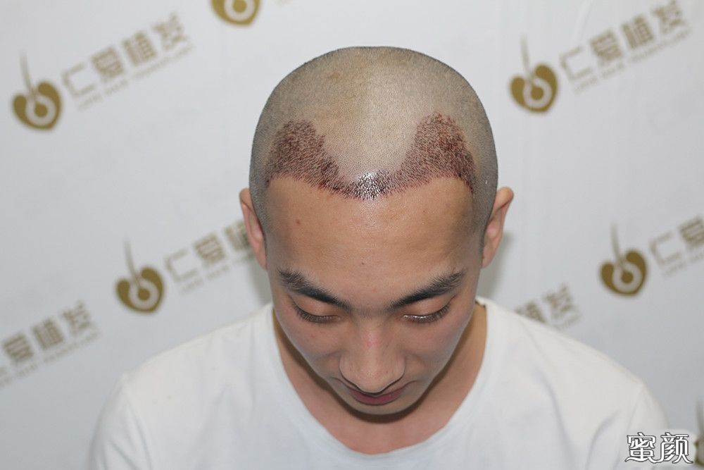 https://img.yiyiaimei.com/mnt/timg/200605/1156435U6-6.jpg