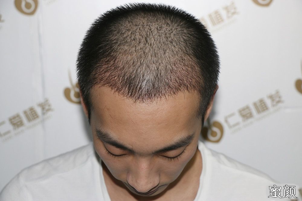 https://img.yiyiaimei.com/mnt/timg/200605/115A14925-7.jpg