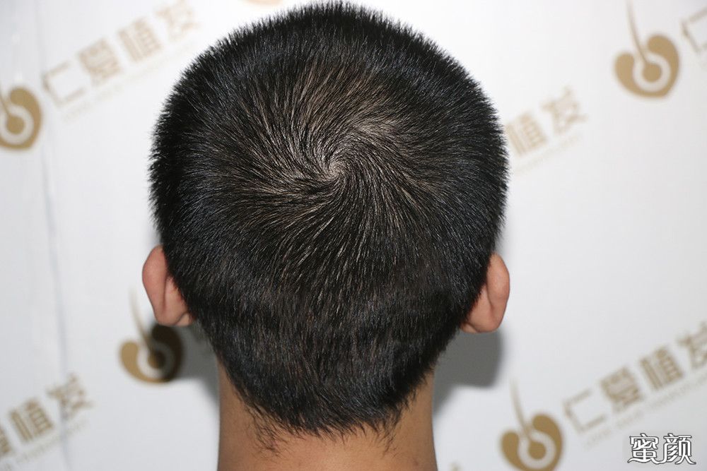 https://img.yiyiaimei.com/mnt/timg/200605/115F01M6-8.jpg