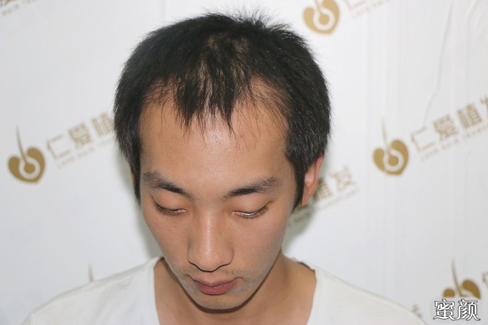 https://img.yiyiaimei.com/mnt/timg/200605/115FM309-9.jpg