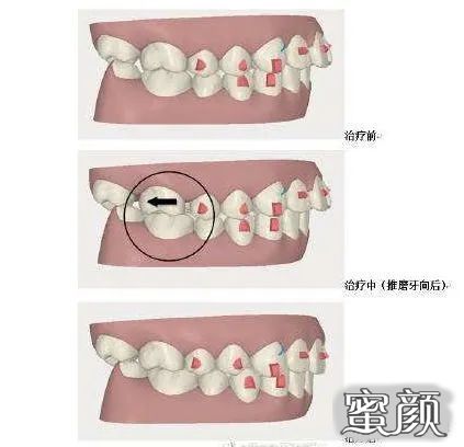 案例图片