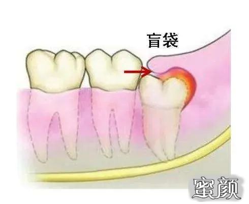 案例图片