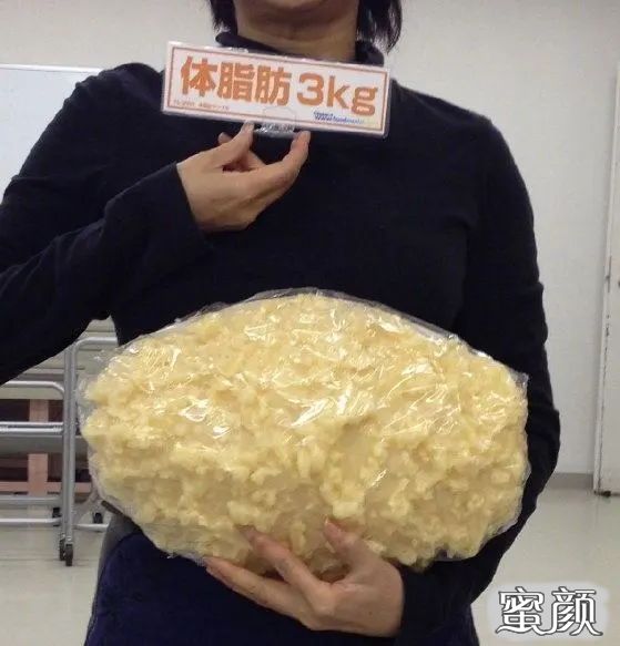 https://img.yiyiaimei.com/mnt/timg/200606/131G21494-3.jpg 案例图片