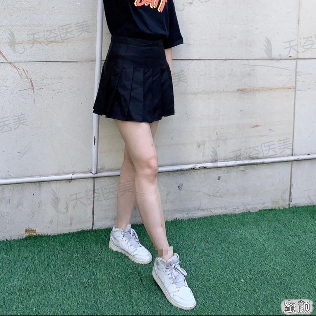 https://img.yiyiaimei.com/mnt/timg/200606/131HHT6-9.jpg 案例图片