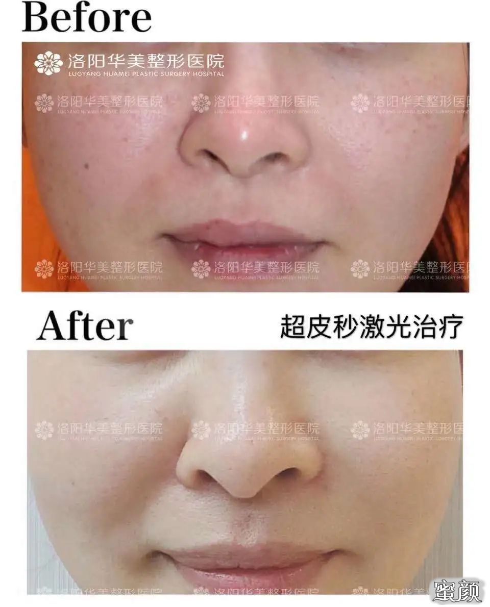 https://img.yiyiaimei.com/mnt/timg/200608/10541a054-5.jpg 案例图片
