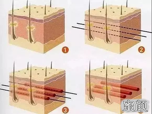 https://img.yiyiaimei.com/mnt/timg/200608/12095W024-2.jpg