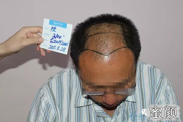 https://img.yiyiaimei.com/mnt/timg/200608/120H34939-3.jpg