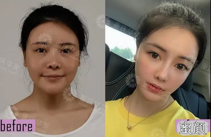 https://img.yiyiaimei.com/mnt/timg/200608/1210022145-7.jpg