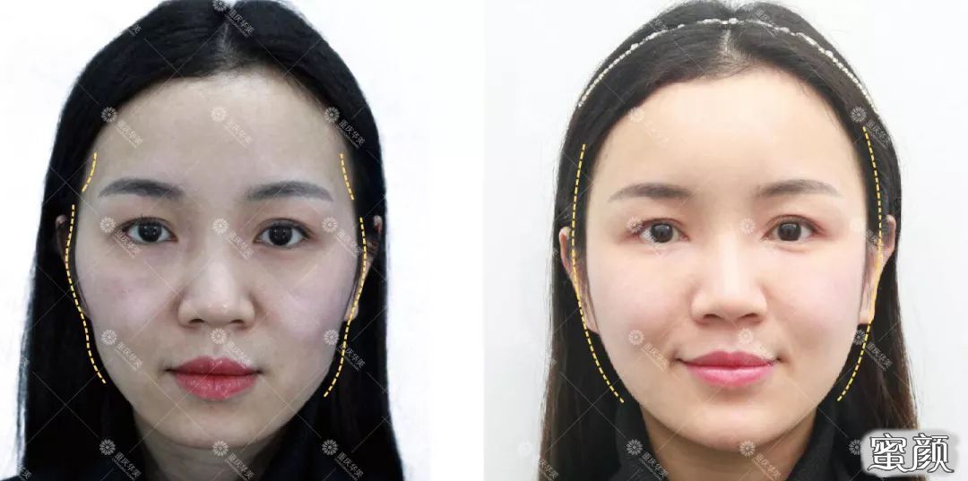https://img.yiyiaimei.com/mnt/timg/200608/12100319B-8.jpg