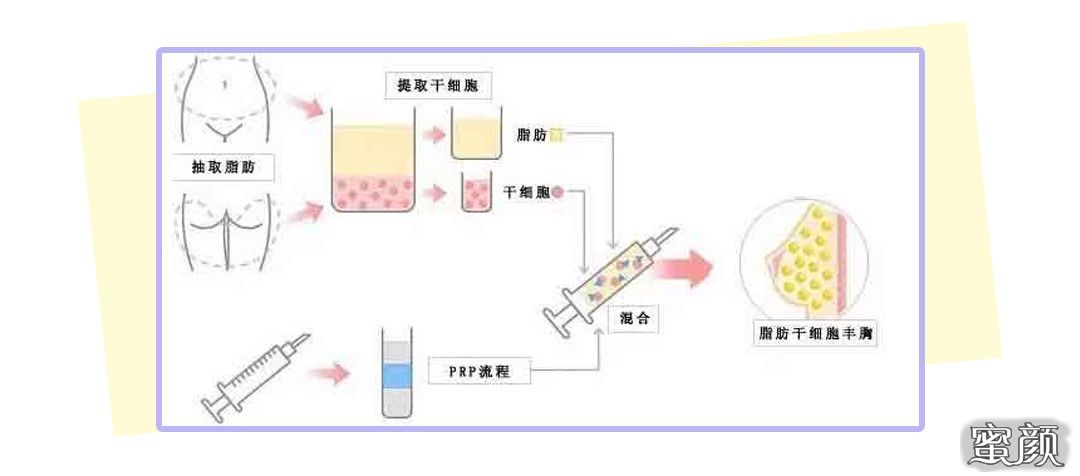 案例图片