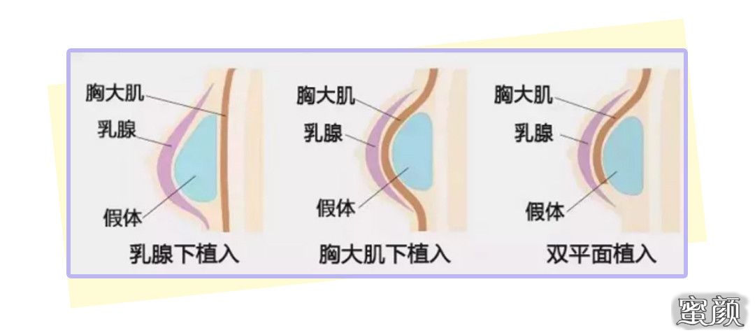 案例图片