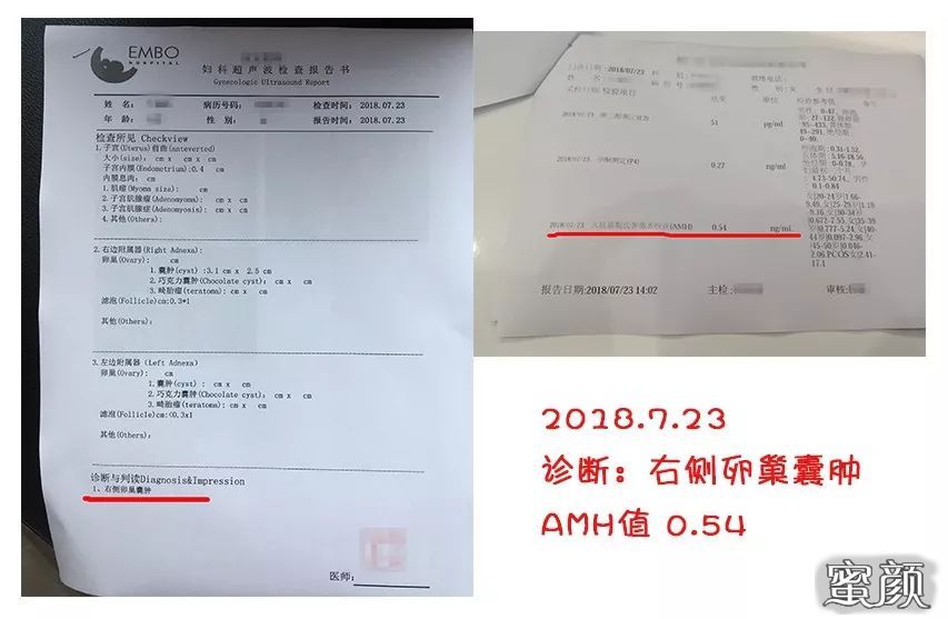 案例图片