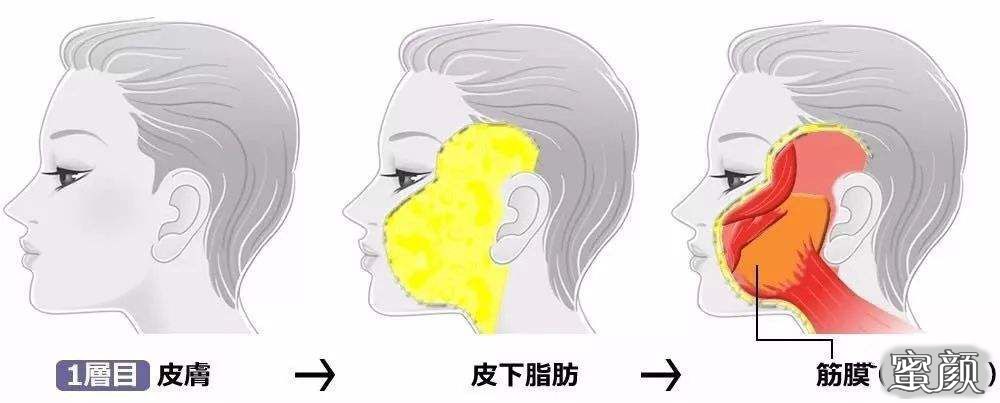https://img.yiyiaimei.com/mnt/timg/200610/12241254L-2.jpg
