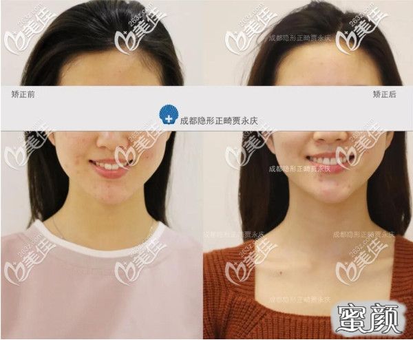 案例图片