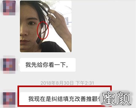 https://img.yiyiaimei.com/mnt/timg/200611/114Q54P7-0.jpg 案例图片
