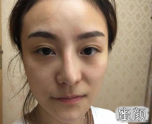 https://img.yiyiaimei.com/mnt/timg/200611/11531KX4-0.jpg