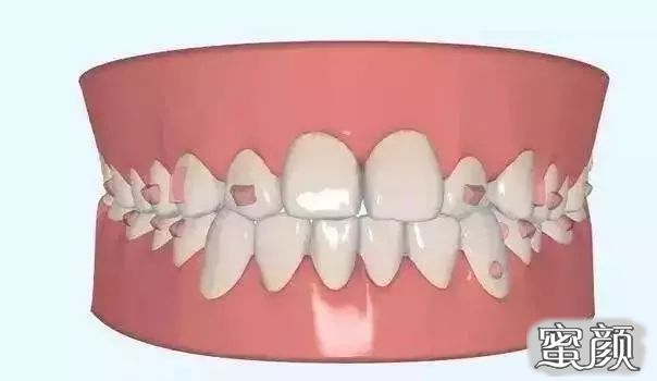 https://img.yiyiaimei.com/mnt/timg/200611/115R21526-0.jpg