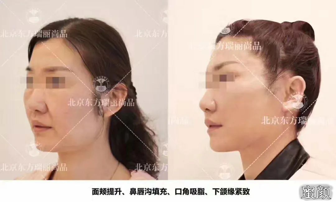 案例图片
