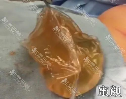 案例图片