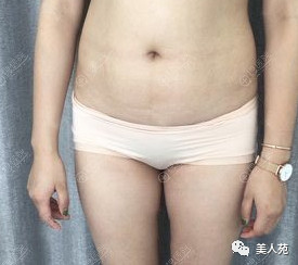 案例图片