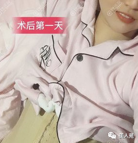 案例图片