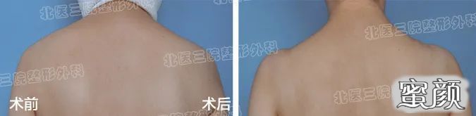 https://img.yiyiaimei.com/mnt/timg/200612/1209432I3-1.jpg